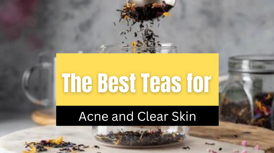 The Best Teas for Acne and Clear Skin